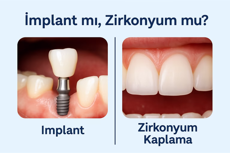 implant mi zirkonyum mu