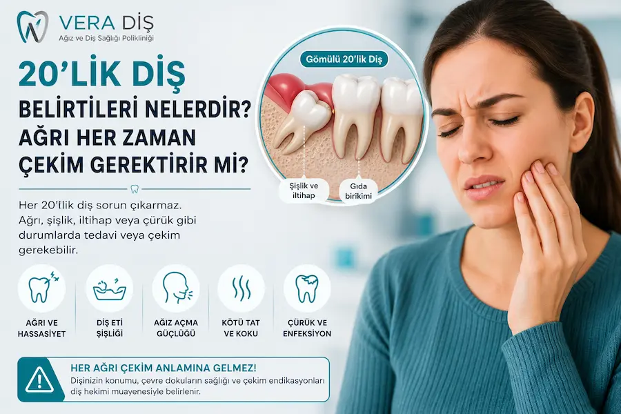 Yarı gömülü 20’lik diş çevresinde gelişen diş eti iltihabı ve perikoronit
