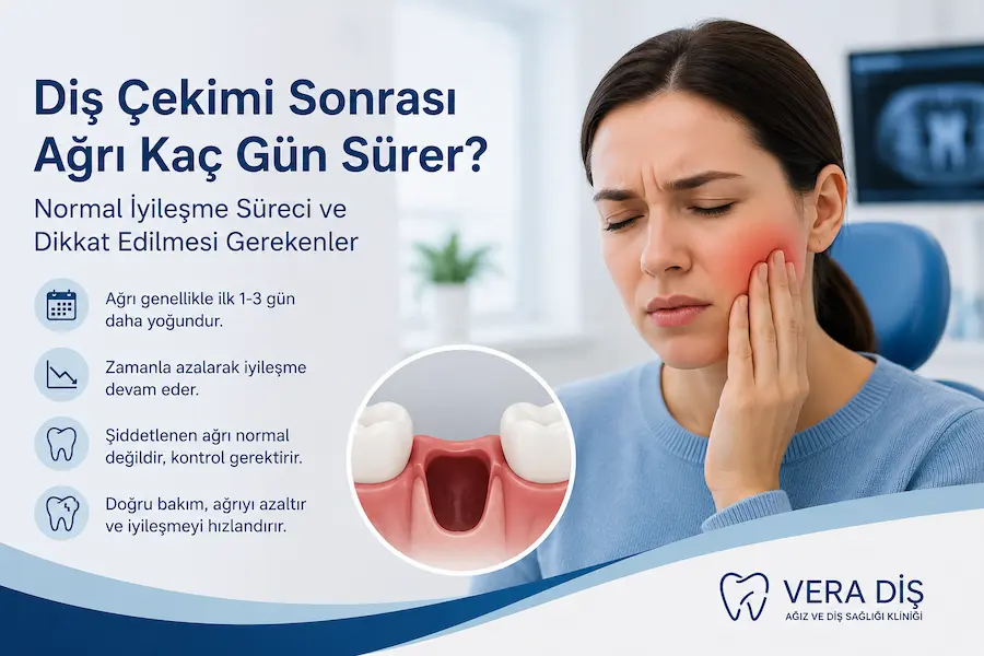 Diş Çekimi Sonrası Ağrı Kaç Gün Sürer? 1 dis cekimi sonrasi agri kac gun surer