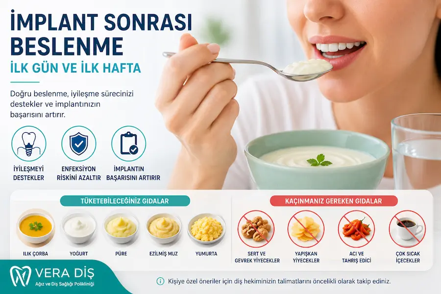 İmplant Sonrası Beslenme: İlk Gün ve İlk Hafta Ne Yenir? 1 İmplant sonrası ilk gün ve ilk hafta için yumuşak beslenme örnekleri