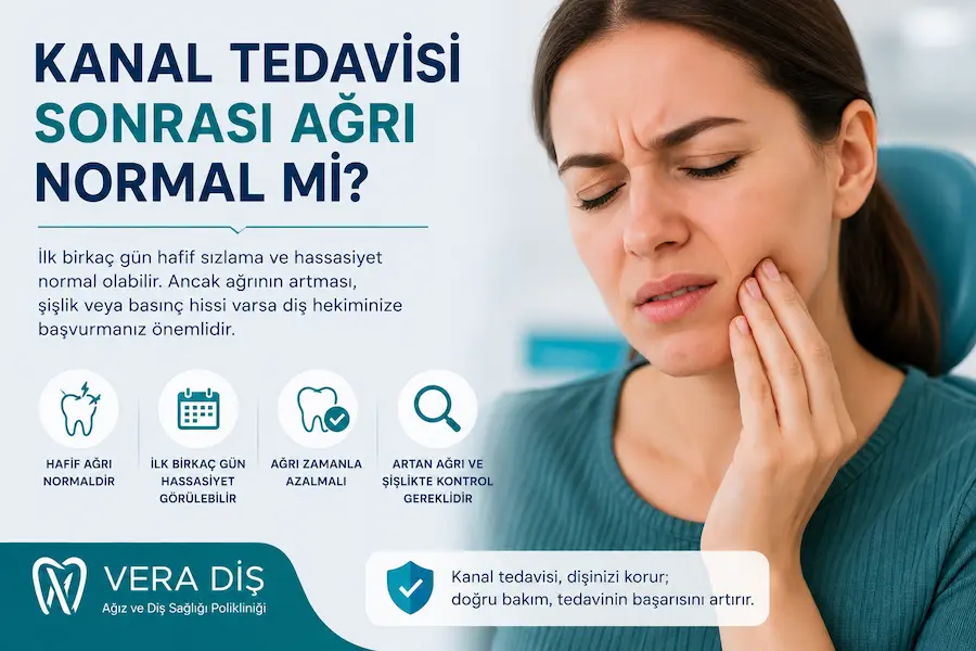 Kanal Tedavisi Sonrası Ağrı Normal mi? Ne Kadar Sürer? 1 Kanal tedavili dişte kök çevresi dokularının hassasiyeti